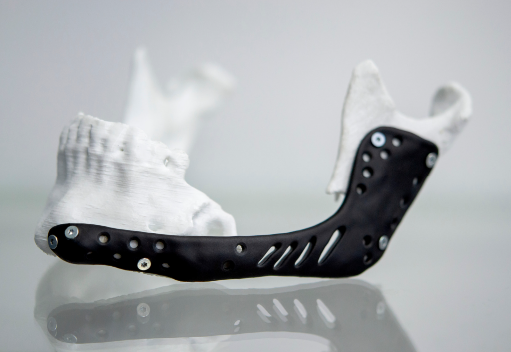 3D nyomtató nyomtat egy 3d szkennelt orvosi eszközt.