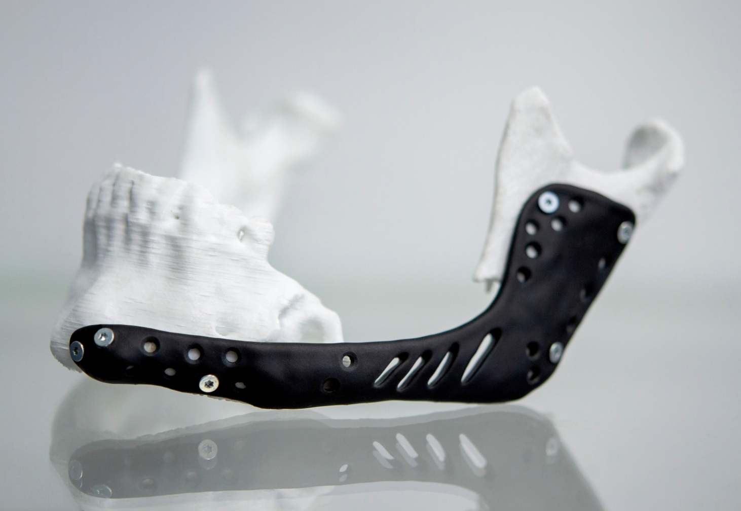 3D nyomtató nyomtat egy 3d szkennelt orvosi eszközt.