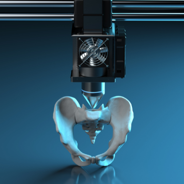 3D nyomtató nyomtat egy 3d szkennelt orvosi eszközt.